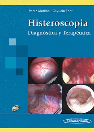 PEREZ:HISTEROSCOPIA + DVD