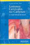 LESIONES CERVICALES NO CARIOSA