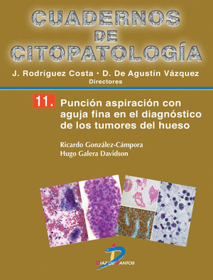 PUNCION ASPIRACION CON AGUJA FINA EN EL DIAGNOSTIC