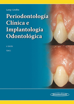 LINDHE:PERIODONTOLOG?A CL?NICA 6A ED. T2