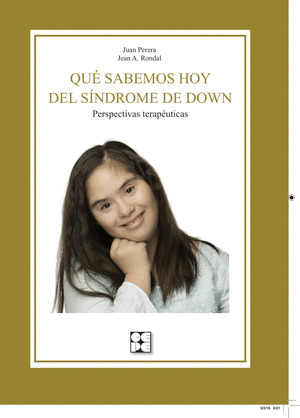 QUÉ SABEMOS HOY DEL SÍNDROME DE DOWN