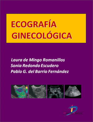 ECOGRAFÍA GINECOLÓGICA