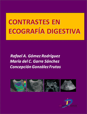 CONTRASTES EN ECOGRAFÍA DIGESTIVA