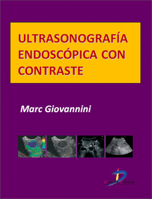 ULTRASONOGRAFÍA ENDOSCÓPICA CON CONTRASTE