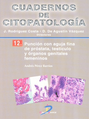 PUNCIÓN CON AGUJA FINA DE PRÓSTATA, TESTÍCULO Y ORGANOS GENITALES FEMENINOS