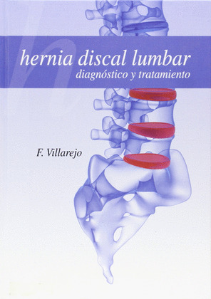 HERNIA DISCAL LUMBAR. DIAGNOSTICO Y TRATAMIENTO
