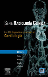 LOS 100 DIAGNÓSTICOS PRINCIPALES EN CARDIOLÓGIA