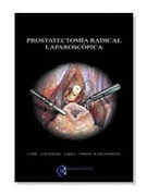 PROSTATECTOMIA RADICAL LAPAROSCOPICA