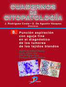 PUNCION ASPIRACION CON AGUJA FINA EN EL DIAGNOSTI-
