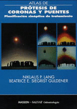 ATLAS DE PROTESIS DE CORONAS Y PUENTES