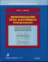MONITORIZACION FETAL ELECTRONICA: INTERPRETACION