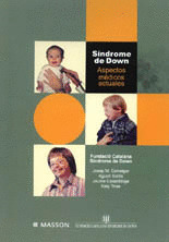SÍNDROME DE DOWN.