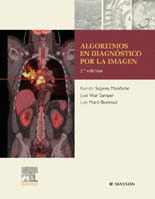 ALGORITMOS EN DIAGNOSTICO POR LA IMAGEN