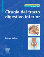 CIRUGÍA DEL TRACTO DIGESTIVO INFERIOR