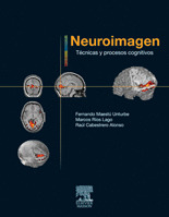 NEUROIMAGEN