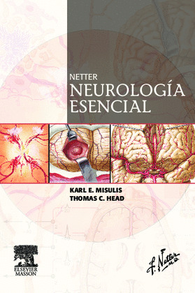 NETTER NEUROLOGIA ESENCIAL