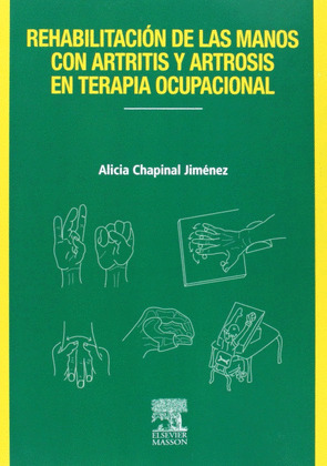 REHABILITACION DE LAS MANOS CON ARTRITIS Y ARTROSIS EN TERAPIA OCUPACIONAL