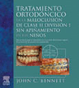 TRATAMIENTO ORTODONTICO DE LA MALOCLUSION DE CLASE II DIVISION 1 SIN APIÑAMIENTO