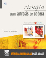 CIRUGIA PARA ARTROSIS DE CADERA