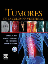 TUMORES EN LA COLUMNA VERTEBRAL