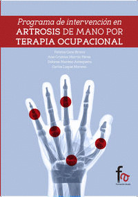 PROGRAMA DE INTERVENCIÓN EN ARTROSIS DE MANO POR TERAPIA OCUPACIONAL