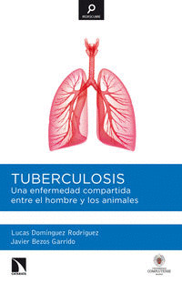 TUBERCULOSIS. UNA ENFERMEDAD COMPARTIDA ENTRE EL HOMBRE Y LOS ANIMALES