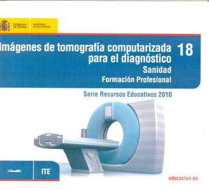 IMÁGENES DE TOMOGRAFÍA COMPUTERIZADA PARA EL DIAGNÓSTICO. SANIDAD. FORMACIÓN PRO