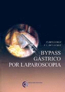 BYPASS GASTRICO POR LAPAROSCOPIA