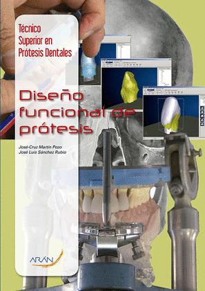 DISEÑO FUNCIONAL DE PRÓTESIS (TÉCNICO SUPERIOR EN PRÓTESIS DENTALES)