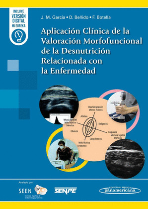 APLICACION CLINICA DE VALORACION MORFOFUNCIONAL DE DESNUTRI