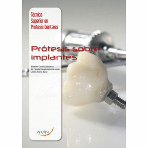 PROTESIS SOBRE IMPLANTES