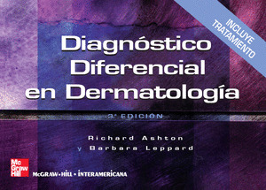 DIAGNOSTICO DIFERENCIAL EN DERMATOLOG{A