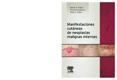 MANIFESTACIONES CUTÁNEAS DE NEOPLASIAS MALIGNAS INTERNAS