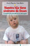 NUESTRA HIJA TIENE SINDROME DOWN