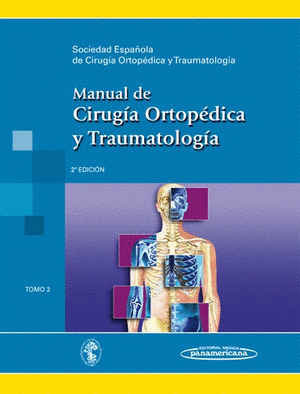 MANUAL CIRUGIA ORTOPEDICA TRAUMATOLOGIA T.2