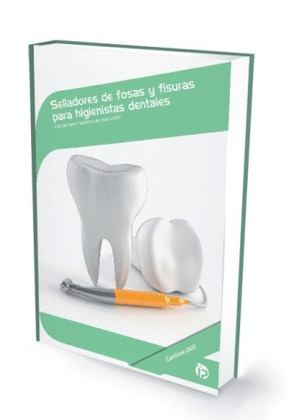 SELLADORES DE FOSAS Y FISURAS PARA HIGIENISTAS DENTALES