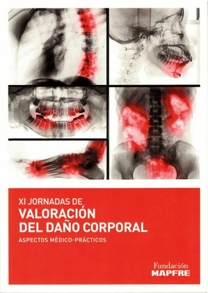 XI JORNADAS DE VALORACIÓN DEL DAÑO CORPORAL