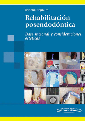 BERTOLDI:REHABILITACI?N POSENDOD?NTICA