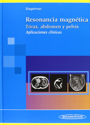 RESONANCIA MAGN?TICA