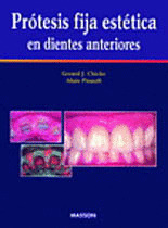 PROTESIS FIJA ESTETICA EN DIENTES ANTERIORES