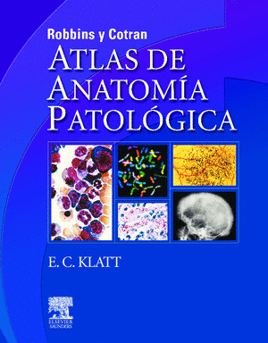 ROBBINS Y COTRAN, ATLAS DE ANATOMIA PATOLOGICA