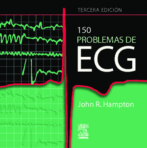 150 PROBLEMAS DE ECG