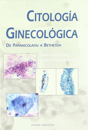 CITOLOGIA GINECOLOGICA DE PAPANICOLAOU A BETHESDA